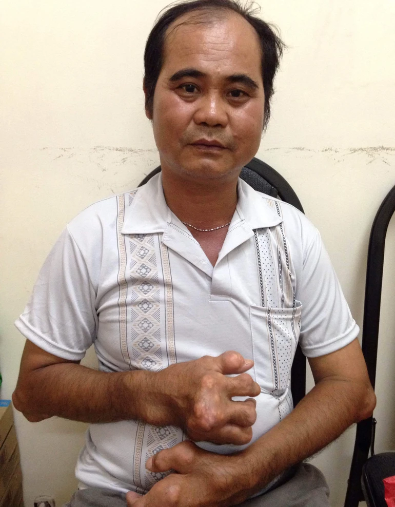 Giúp đỡ vợ chồng anh Minh điều trị bệnh